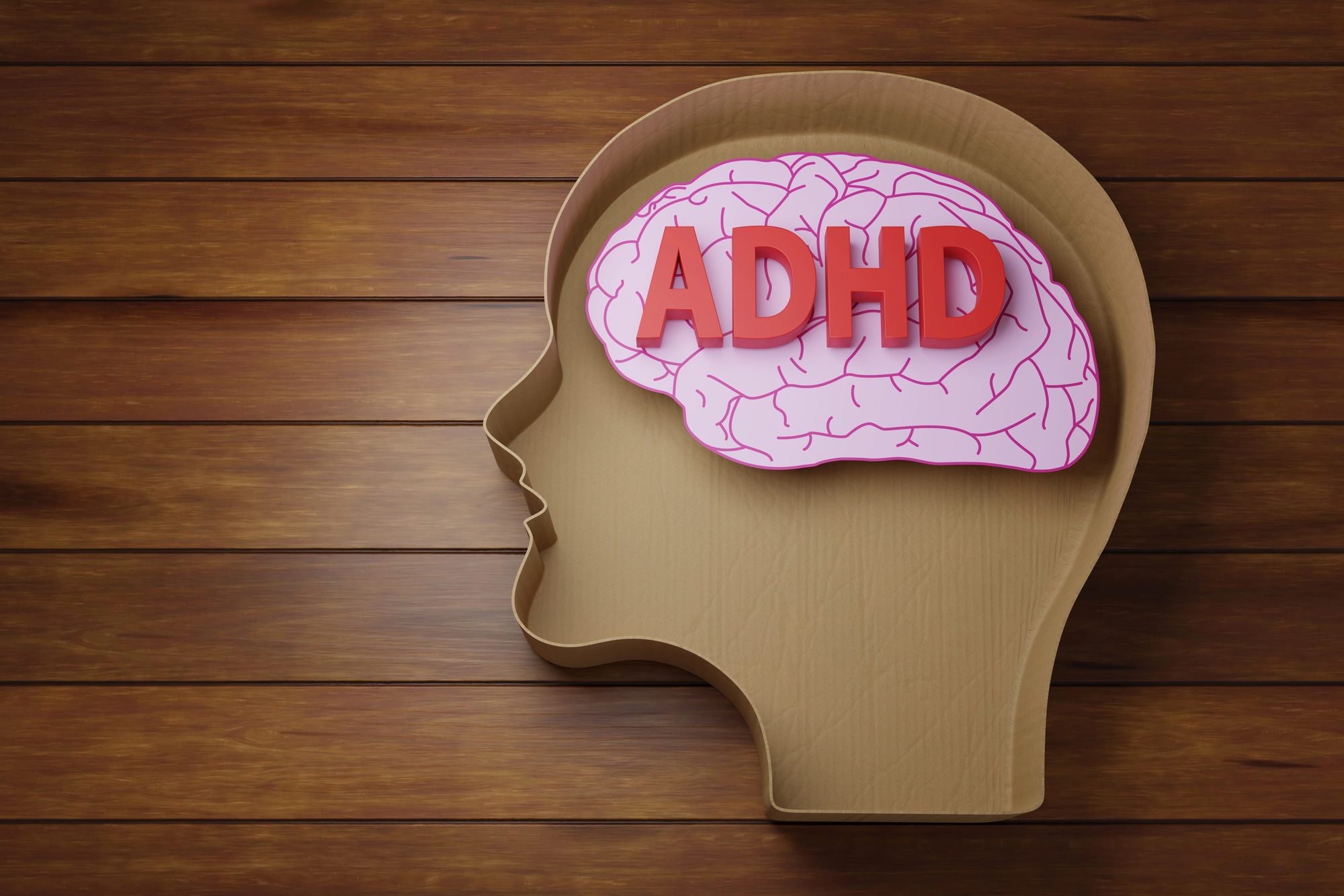 Red letters ADHD on pink brain paper cut in human head shaped brown cardboard container on wooden table.
